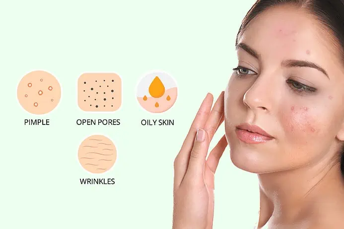 Complete-Pimple-Cure-Solution Product details 1
