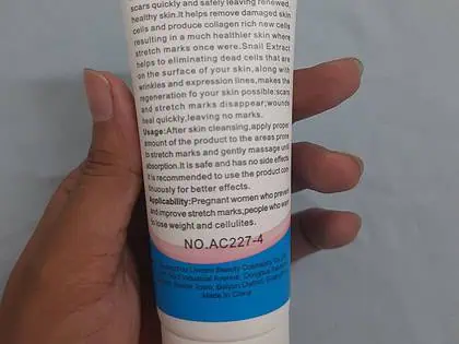 Anti Stretch Mark Cream For Pregnancy Care photo review