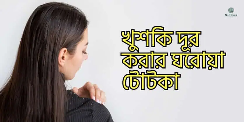 খুশকির কারণে চুল ড্যামেজ হয়ে প্রচুর চুল পড়ে